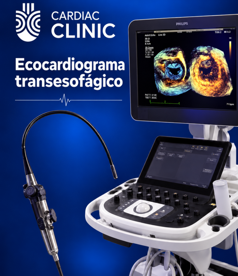 Ecocardiograma transesofágico